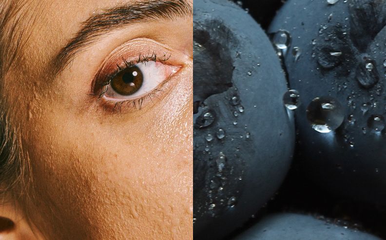 Cernes sous les yeux : causes, types et solutions naturelles pour les atténuer durablement